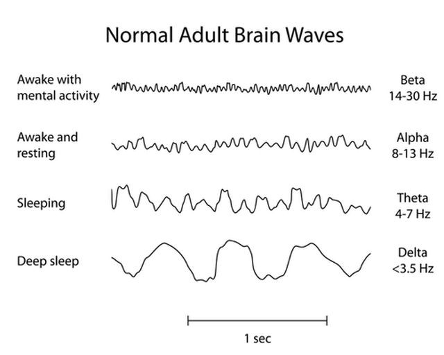 brainwaves.jpg
